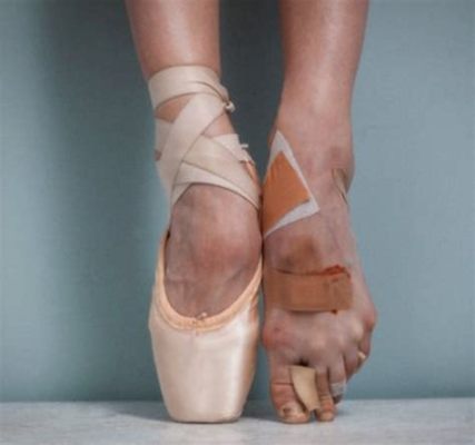 does ballet hurt your feet does it improve your posture?